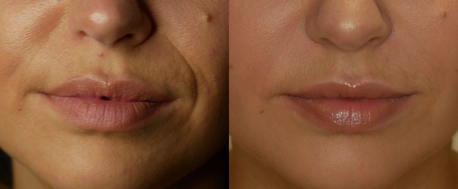 Before & Afters